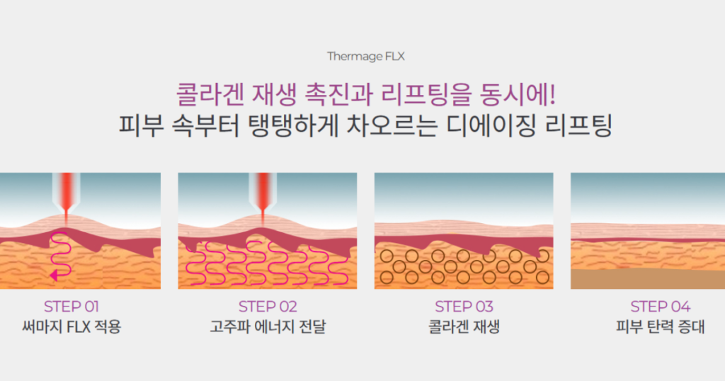 부천 써마지 잘하는 병원 추천! 효과·비용·병원 선택법 총정리 2