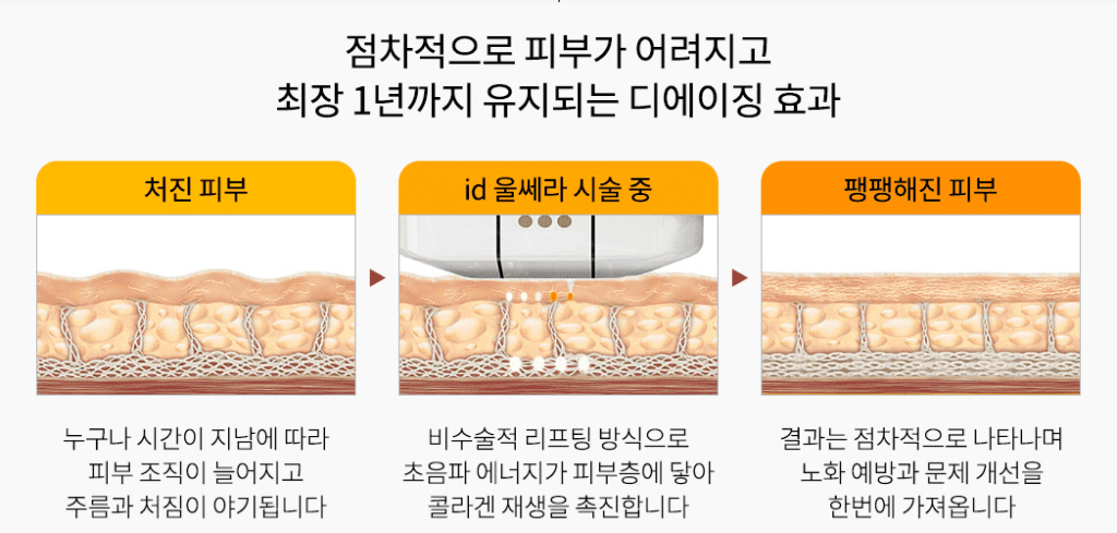 강남 울쎄라 잘하는 병원 추천! 효과·가격·비용까지 총정리 no.1 5