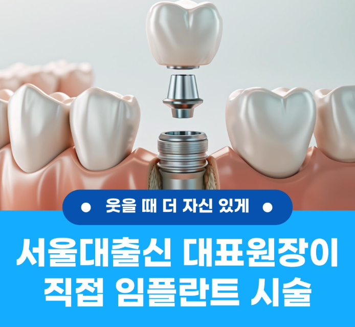 임플란트비용, 임플란트가격 비교로 알 수 없는 진짜 차이 4 임플란트비용, 임플란트가격 비교로 알 수 없는 진짜 차이 3